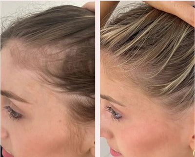 Electric Massage Comb for Scalp and Hair Care