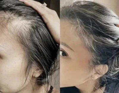 Electric Massage Comb for Scalp and Hair Care