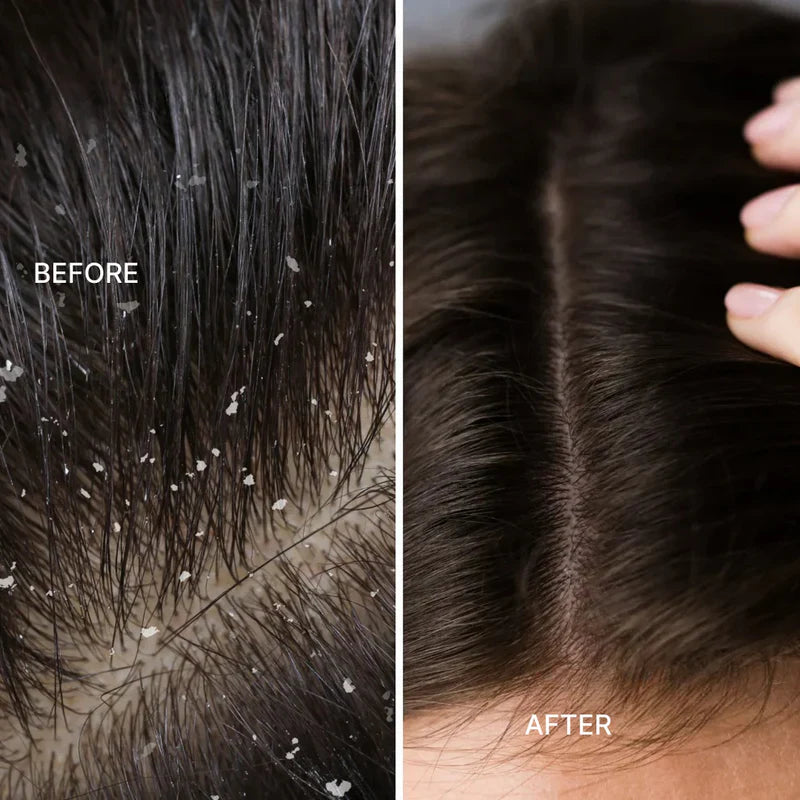 Electric Massage Comb for Scalp and Hair Care