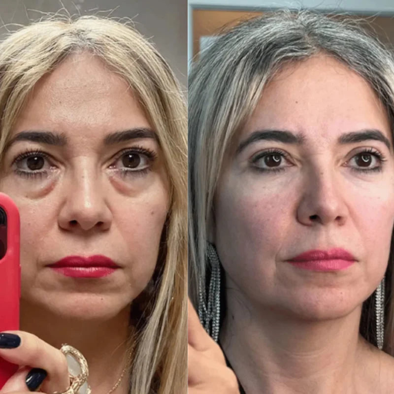 3D Micro-Current Pulse Eye Massager