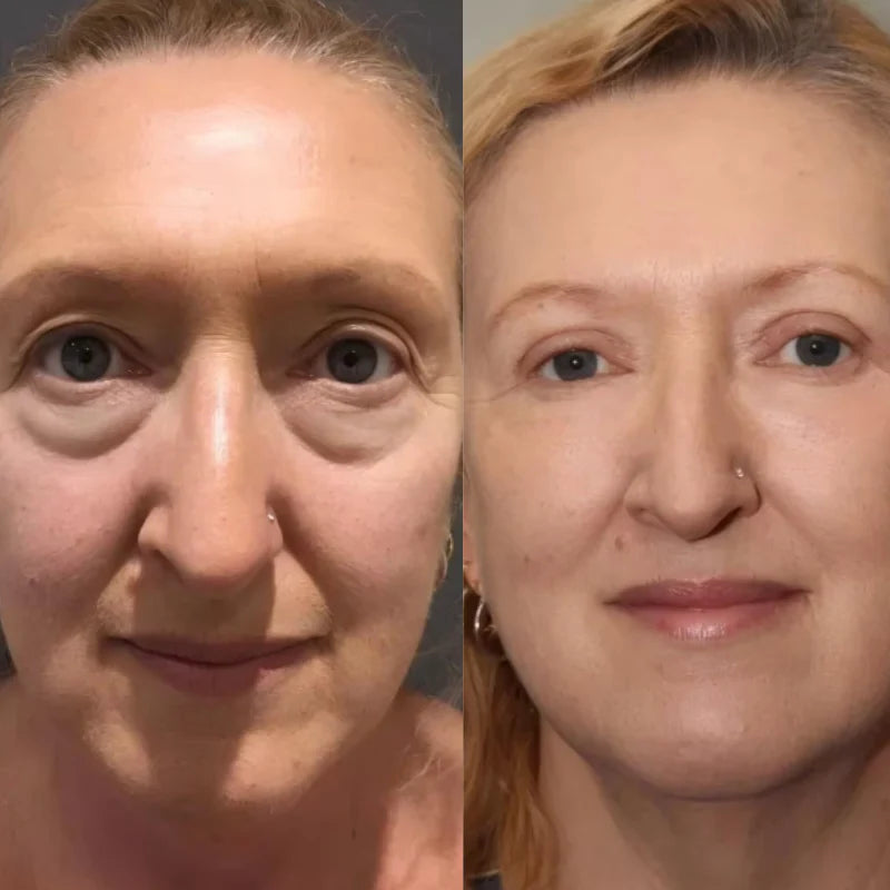 3D Micro-Current Pulse Eye Massager