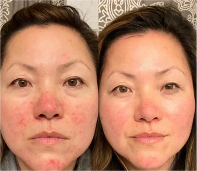 3D Micro-Current Pulse Eye Massager